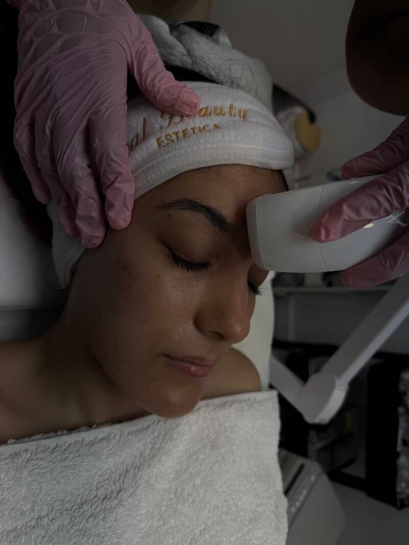 HYDRAFACIAL