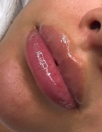 Hydra Lips Gloss